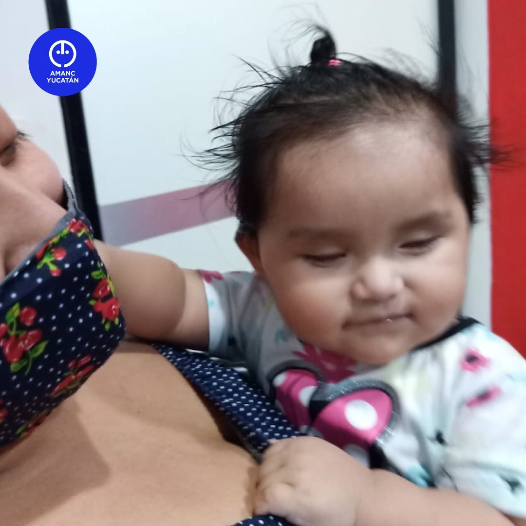 Prótesis oculares para Evelyn